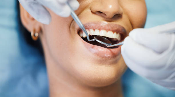 Best Emergency Root Canal Treatment in West Point, MS